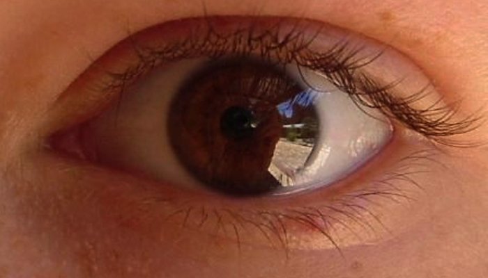 vision-impairement due to retinitis pigmentosa